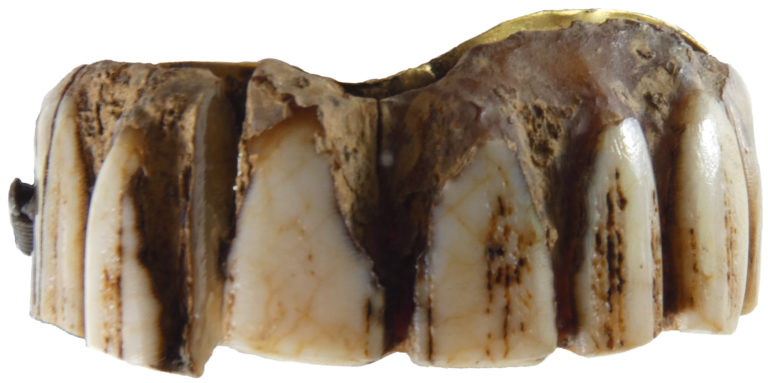teeth gems ancient